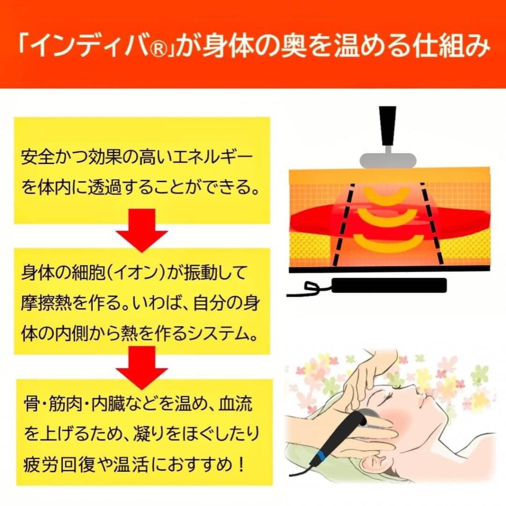 脂肪吸引後のインディバケア