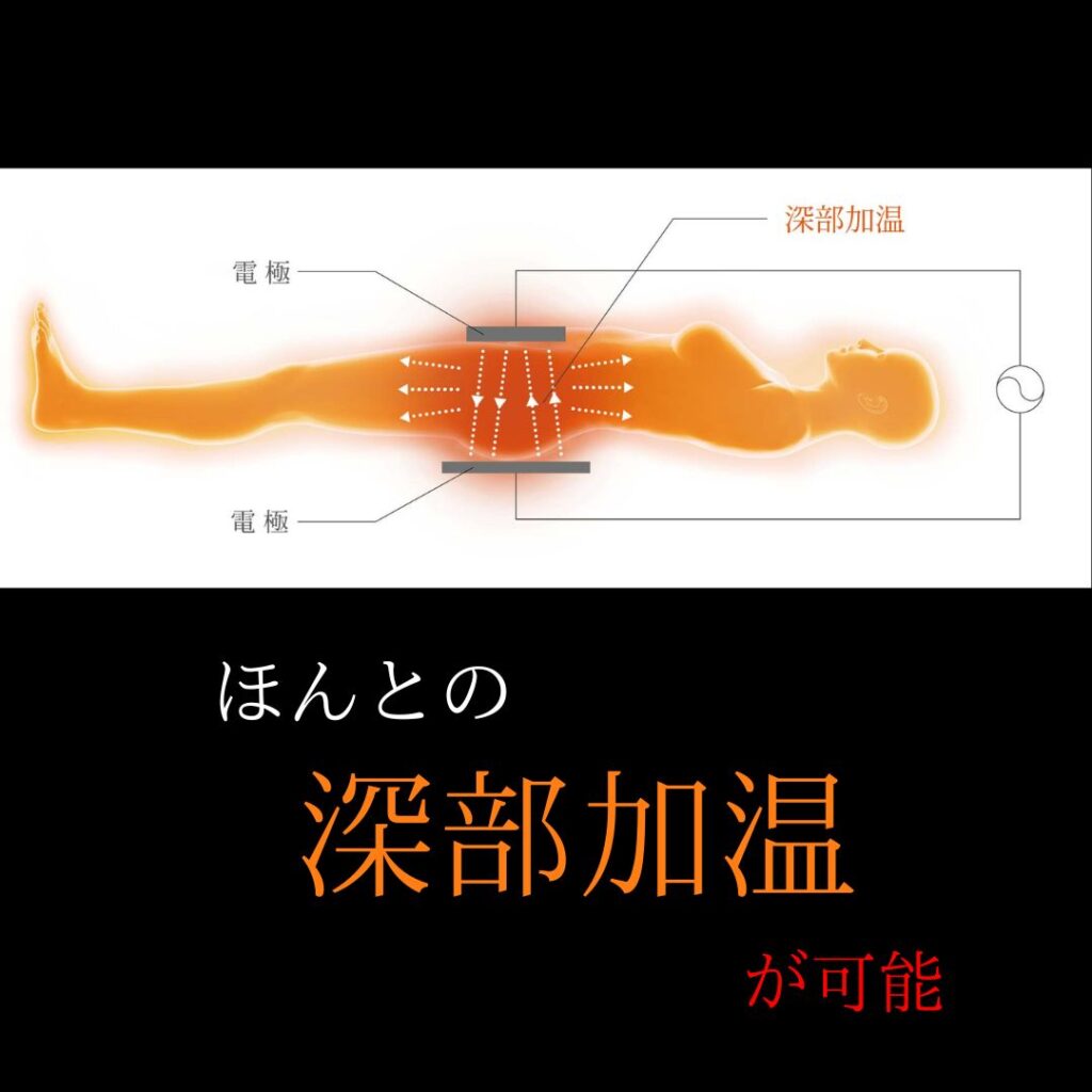 男前は通ってる！男性がインディバサロンで得られる５つの健康・美容効果